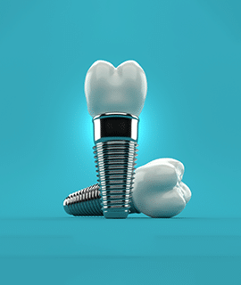 img-implants
